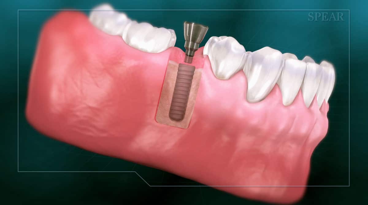  Archives Brooks Stevens General Dentistry Dr. Brooks Stevens